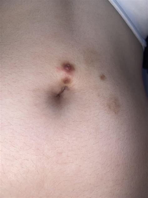 Has my navel piercing rejected/is rejecting or is it just infected? if ...