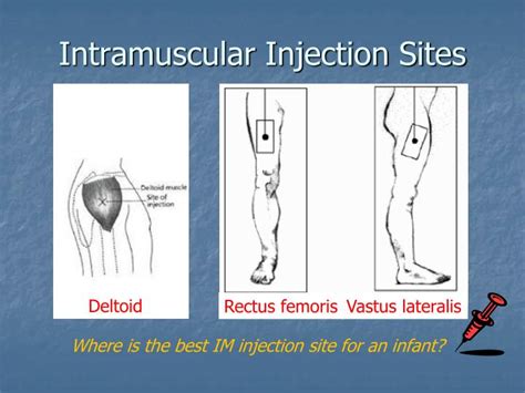 Image result for Injection Sites