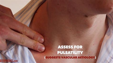 Neck Lump Examination - OSCE Guide | Geeky Medics