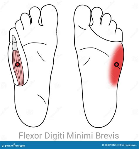 Flexor Digiti Minimi Brevis Stock Illustration - Illustration of feet ...