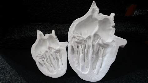 Anatomical Heart 3D Print Model at Karol Graves blog