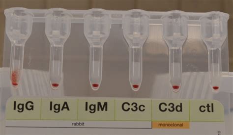 Image result for Dat Positive