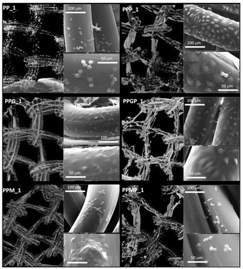 Bioinspired Hydrogel Coating Based on Methacryloyl Gelatin Bioactivates ...