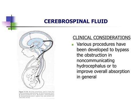 Kuvatulokset haulle cerebrospinal fluid