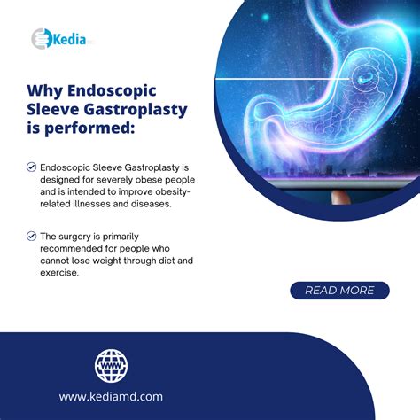 Endoscopic Sleeve Gastroplasty Qualifications at Joan Leet blog