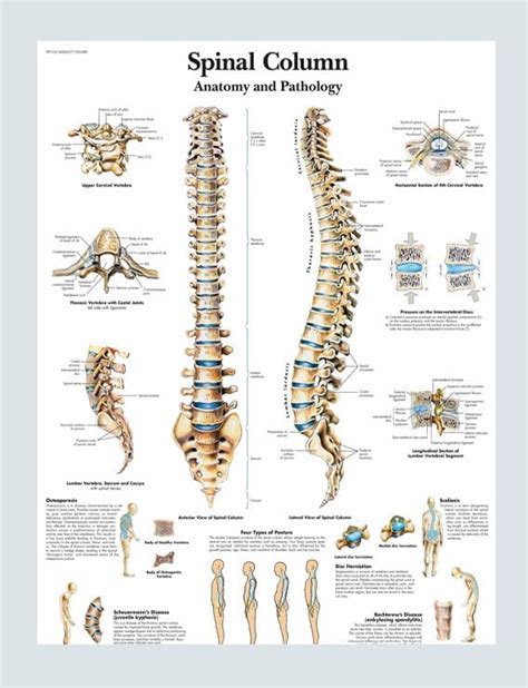 Spinal Column Anatomy & Pathology Wall Chart – 52 × 70 cm Thick Glossy ...