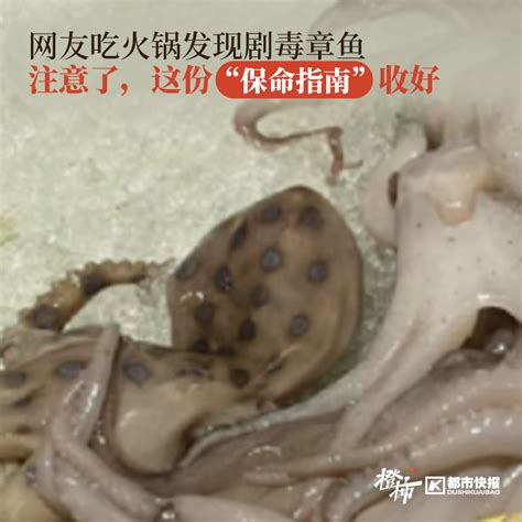湛江：误食蓝环章鱼中毒女子被送进ICU 目前仍在抢救中