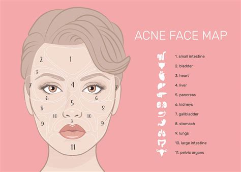 Acne Face Map: The Cause of These Breakouts | Healthy Türkiye