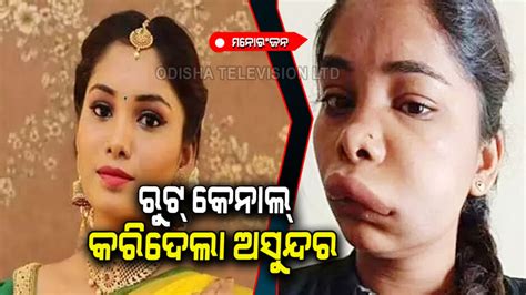 କାଳ ହେଲା ରୁଟ୍ କେନାଲ୍; ହଜିଗଲା ଅଭିନେତ୍ରୀଙ୍କ ସୌନ୍ଦର୍ଯ୍ୟ