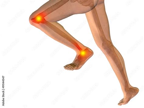 Pain 的图像结果