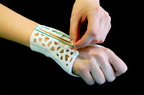 Image result for Inlab Splint Design