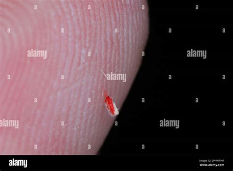 Splinter Finger 的图像结果