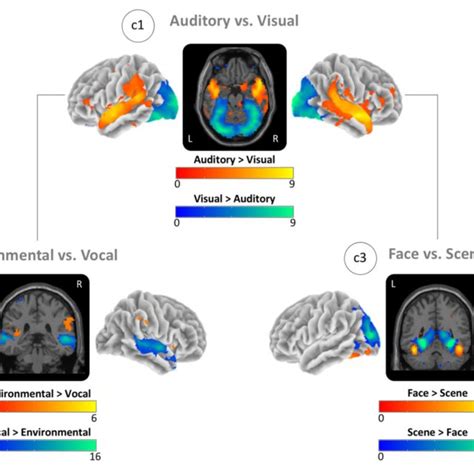 Image result for Visual vs Auditory Processing