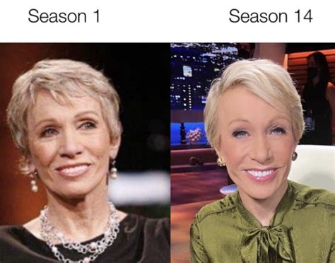 Barbara Corcoran Reveals She's Gotten 2 Facelifts