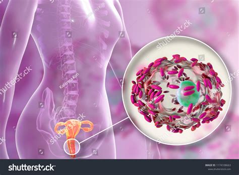 434 Bacterial Vaginosis Images, Stock Photos & Vectors | Shutterstock
