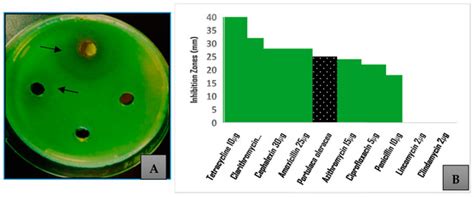 Quorum Quenching of P. aeruginosa by Portulaca oleracea Methanolic ...