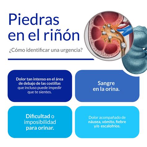 Dolor En Los Riñones