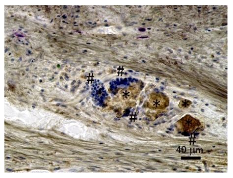 Bone Regeneration of Critical-Size Calvarial Defects in Rats Using ...