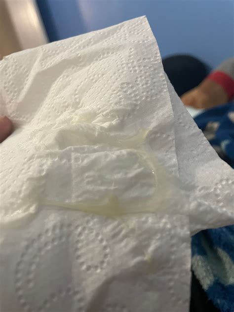 Mucous plug vs discharge | BabyCenter