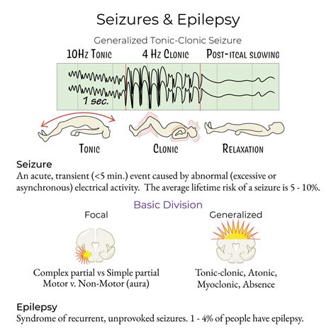 Seizure Types