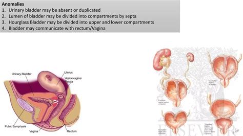 Development of urogenital system I | PPTX