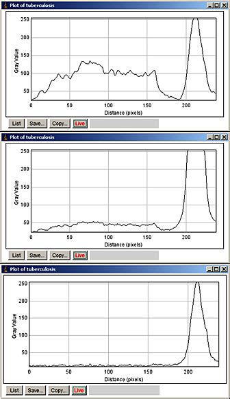 Image result for Image Processing Using ImageJ