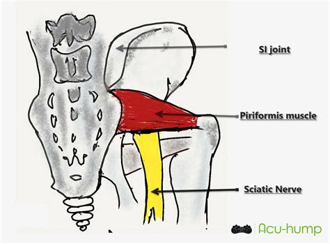 Is Heat Good for Piriformis Syndrome? - Acu-hump Blog