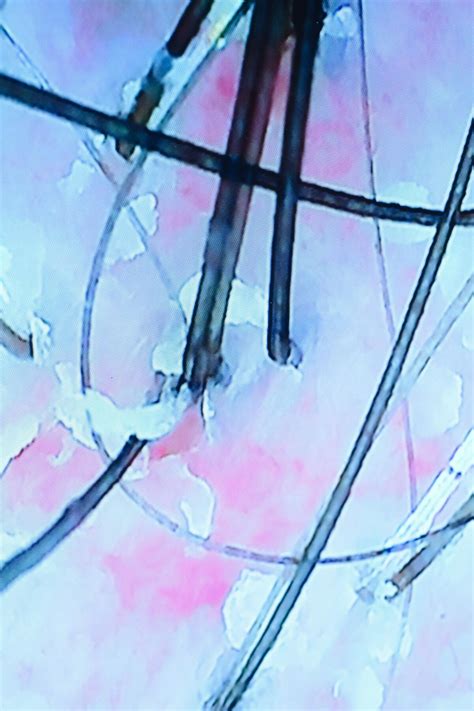 See your scalp's health with this luxury head spa treatment - Los ...