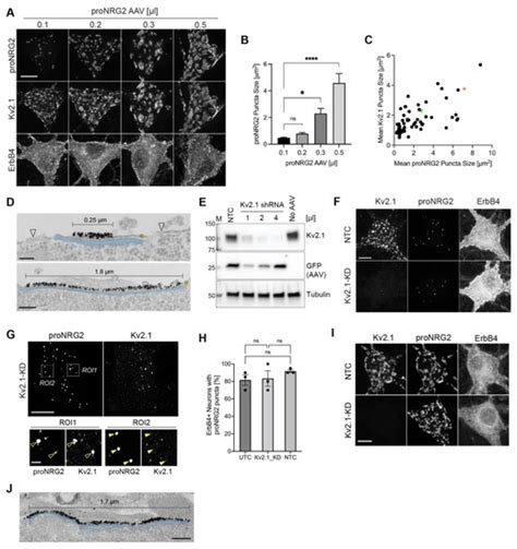 ER-PM Junctions on GABAergic Interneurons Are Organized by Neuregulin 2 ...