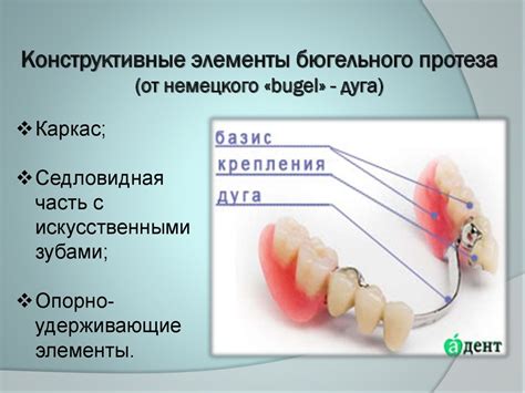 Показания к применению бюгельных протезов: Установка бюгельных протезов ...