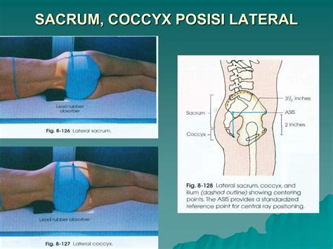 6. TR Sacrum dan coccyx-gs.ppt