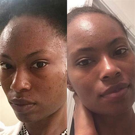 Radiance Serum Vitamin C, Peptides, CoQ10, Niacinamide, HA, 58% OFF