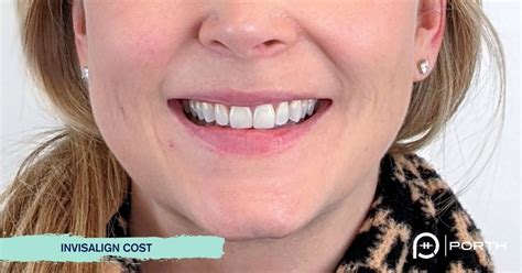 Invisalign cost | Modern Bellevue Orthodontics