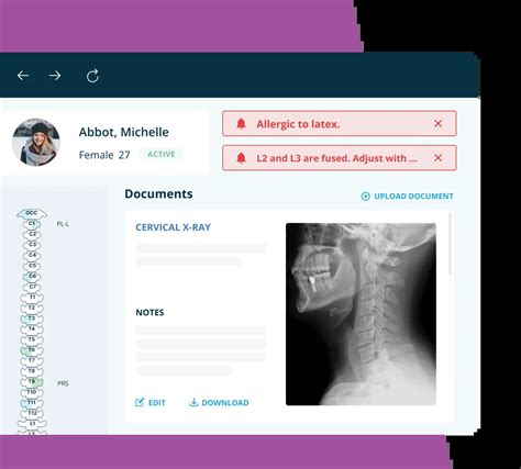 Image result for Chiro Software