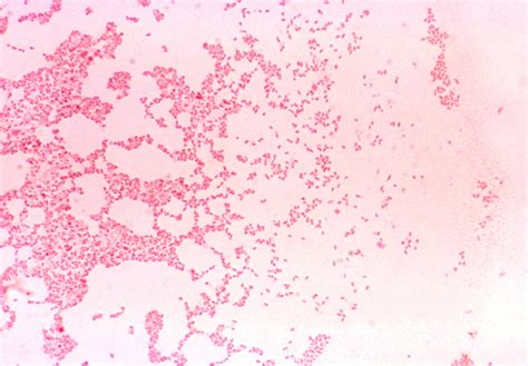 Free picture: brucella melitensis, gram, negative, coccobacillus ...