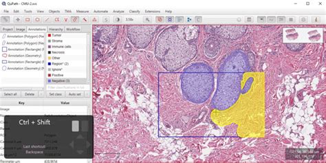 QuPath Tutorial 的图像结果