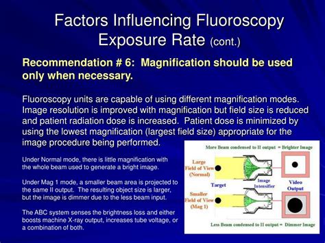 Image result for Fluoroscopy Magnification