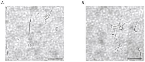Kcnj16 (Kir5.1) Gene Ablation Causes Subfertility and Increases the ...