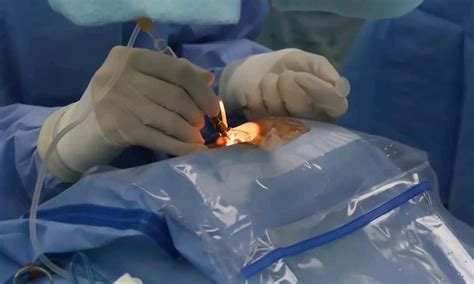 Doctors at Mhaske Hospital Discover Stent Left in Man's Stomach from ...