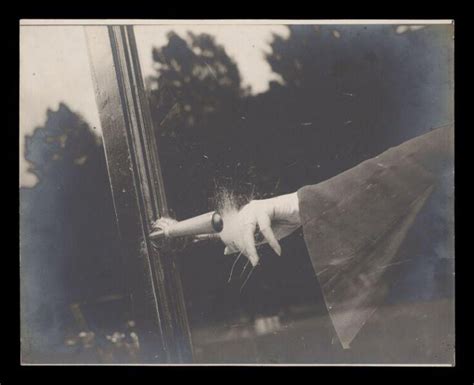 Image result for Exploding Orange Hand Injury