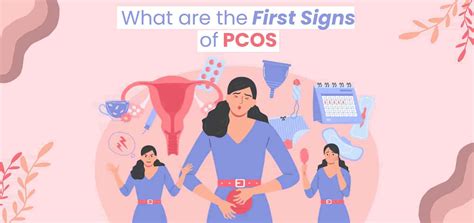 What are the first signs of PCOS: Early symptoms many women miss