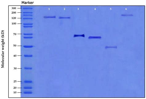 Novel Amoxicillin-Loaded Sericin Biopolymeric Nanoparticles: Synthesis ...