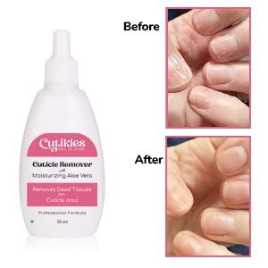 Buy CUTIKLES - Cuticle Remover with Moisturizing Aloe Vera. Removes ...