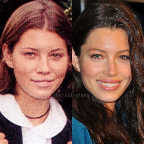 Jessica Biel Face Surgery