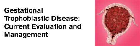 Gestational Trophoblastic Disease: Current Evaluation and Management