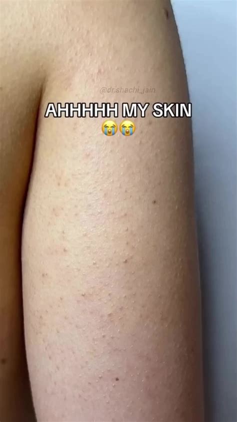 Pin by Mojgan Mont on Healthy | Strawberry legs, Skin care, Baking soda shampoo