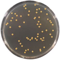 下列属于菌落特征的是大肠杆菌菌落特征2022已更新今日推荐