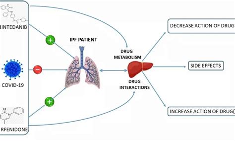 Nintedanib and pirfenidone combo tied to less decline in FVC compared ...