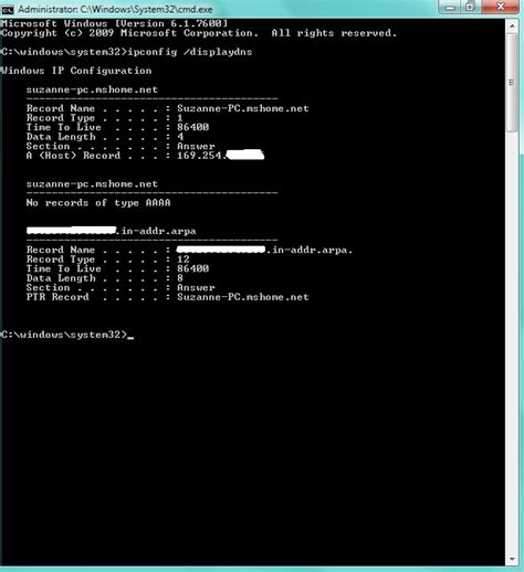 Image result for Local Area Connection Windows 1.0