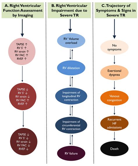 Unmet Needs in the Assessment of Right Ventricular Function for Severe Tricuspid Regurgitation